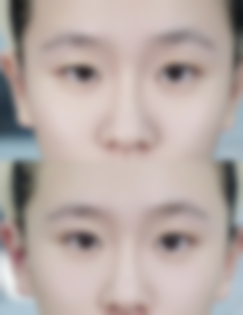 重庆花喜海蓝医疗美容门诊部擅长项目。