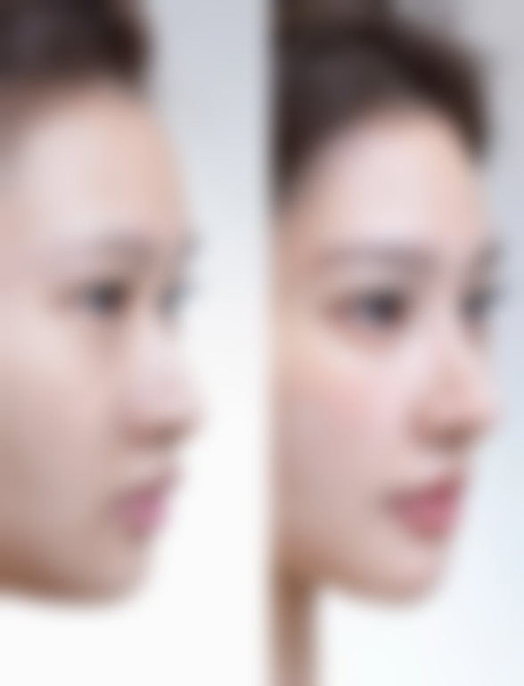 衡水美达皮肤医疗美容诊所治疗反馈与口碑评价。