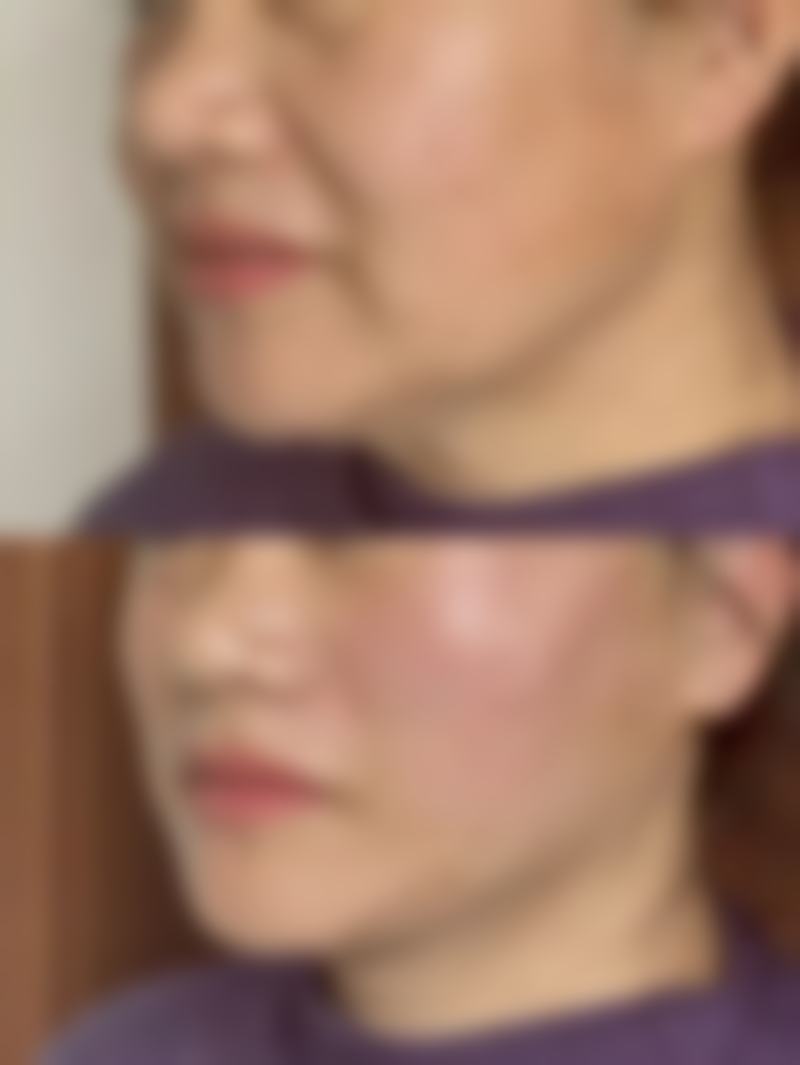 重庆花喜海蓝医疗美容门诊部医生团队经验稳定。