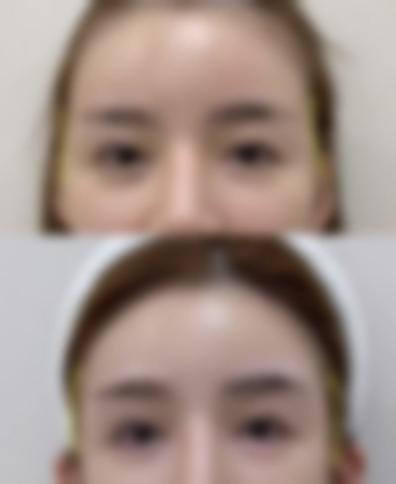 昆山陈医生整形医疗美容诊所擅长项目。