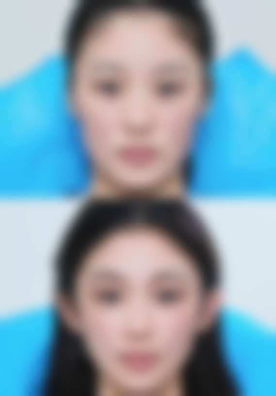 合肥未莱医疗美容医院收费价格表