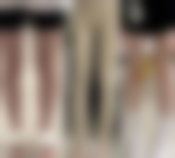 韩国SIGNATURE整形外科口碑评价与项目分享：