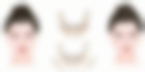 郑州悦美医学美容医院治疗反馈与口碑评价。