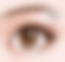 深圳美诚整形医院治疗反馈与口碑评价。