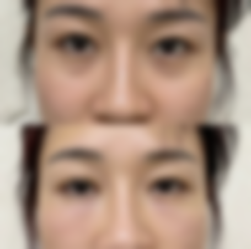 福州中联美康整形美容医院项目有哪些优势？