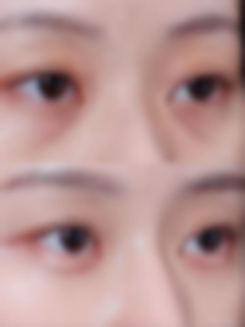 呼和浩特云美国内外医疗美容整形医院口碑评价与项目分享：