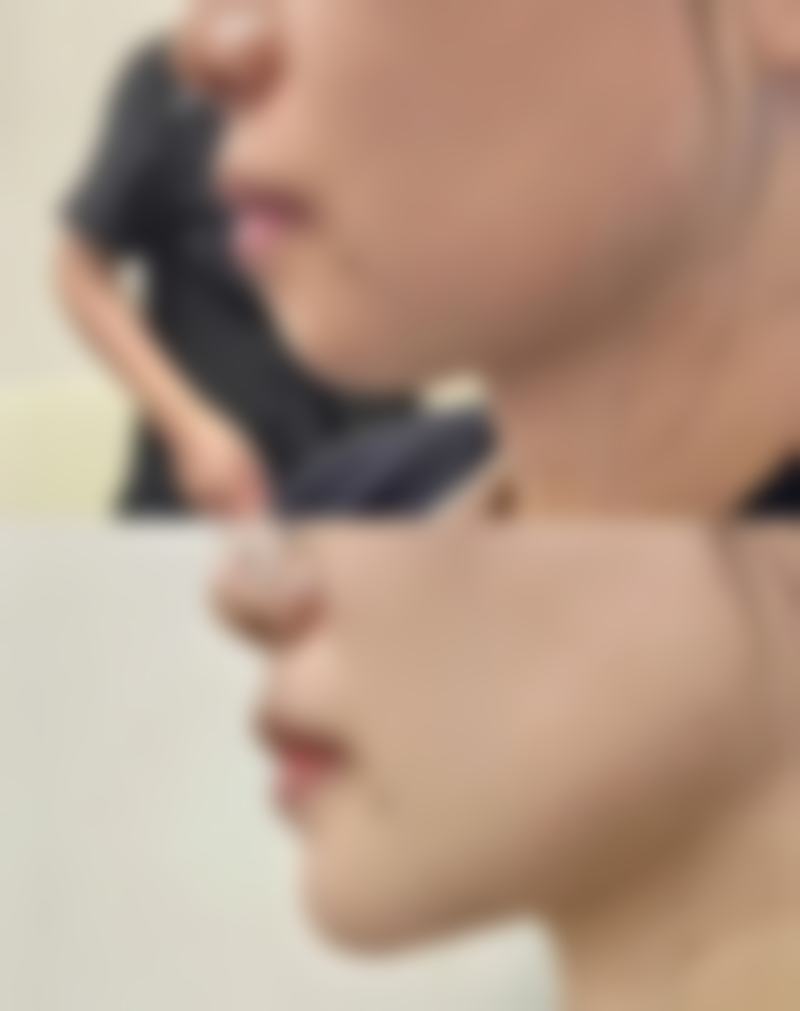 韩国SIGNATURE整形外科擅长项目