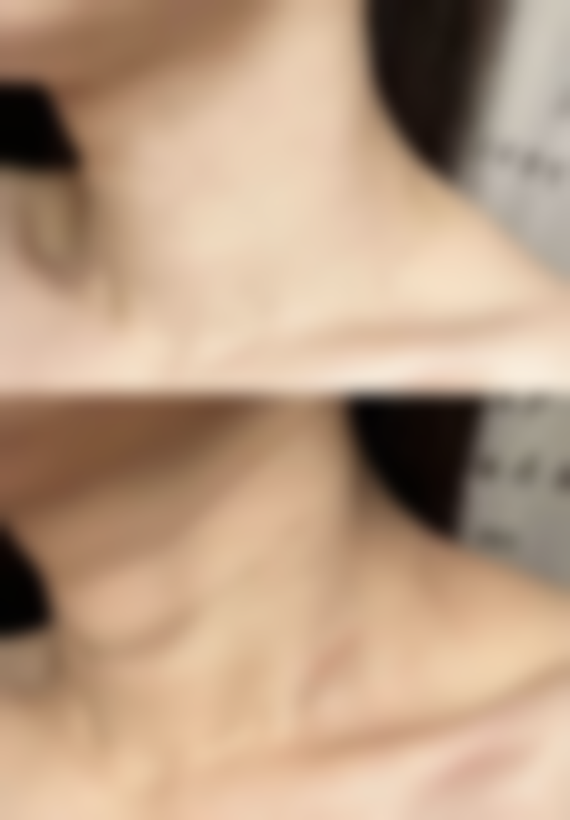 赣州虔美整形医院治疗反馈与口碑评价