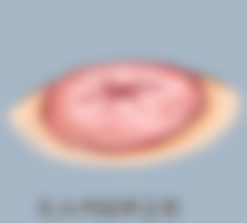 石家庄润美医疗美容门诊部治疗反馈与口碑评价。