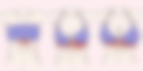 吉首希美医疗美容门诊部擅长项目。