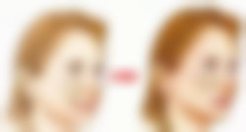 湖州福佑整形医院预约挂号方式。