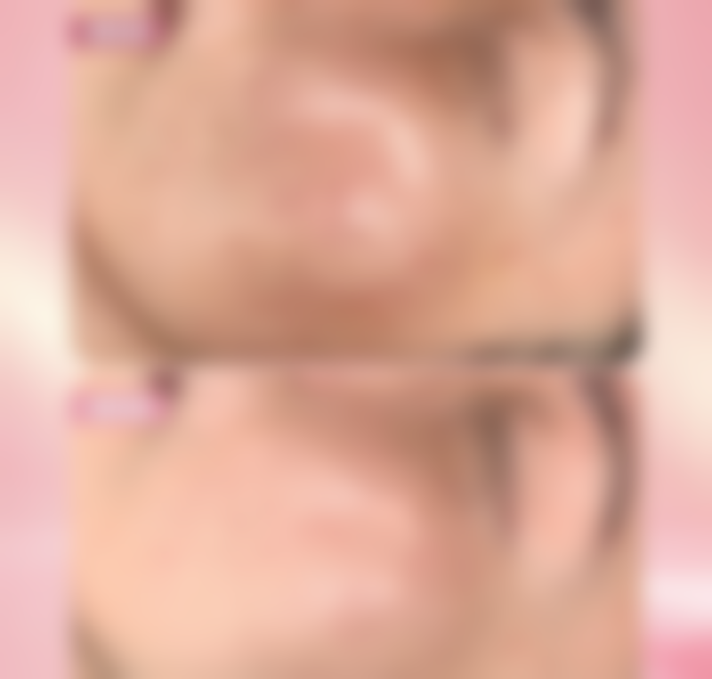 金华东阳丽莱医疗整形美容治疗反馈与口碑评价。