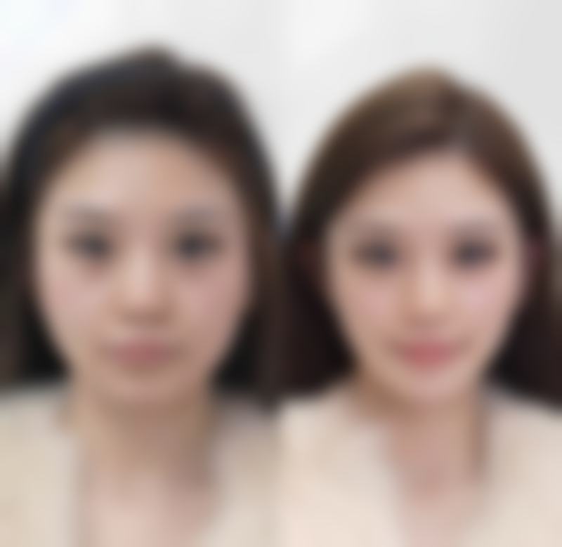 广西中 医 药大学附属瑞康医院整形美容中 心项目优势。