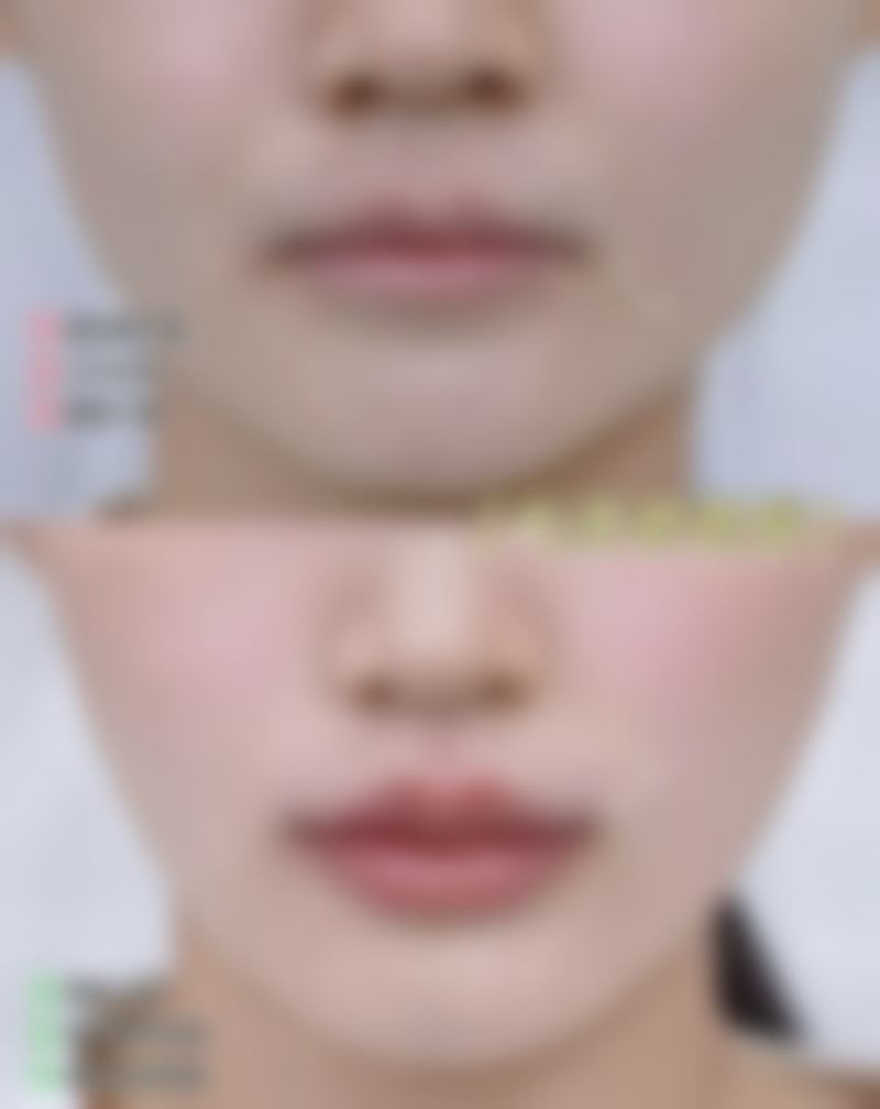 广西中 医 药大学附属瑞康医院整形美容中 心2026年价格收费表: