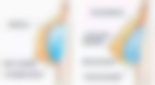 深圳希思医疗美容擅长项目。