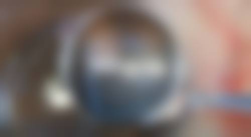 上饶德尔美客医疗美容门诊部口碑评价与项目分享: