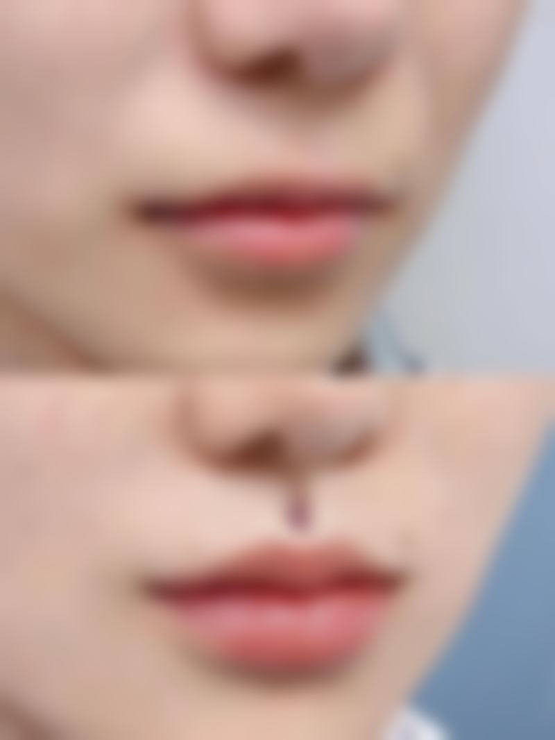 焦作金华医疗美容诊所口碑评价与项目分享：