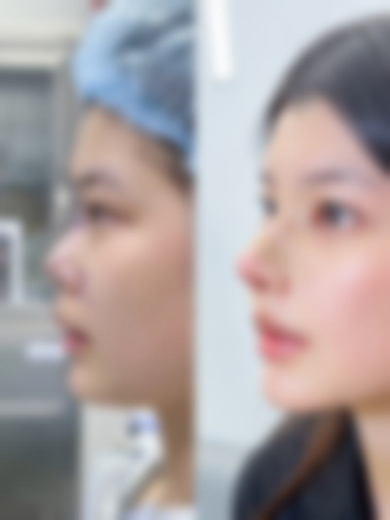 吉安天使悦美医疗美容诊所预约挂号