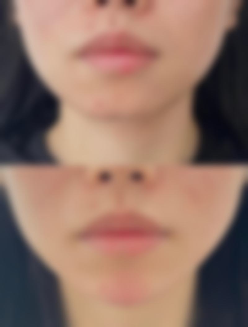 宜宾陈清整形美容门诊部擅长项目。