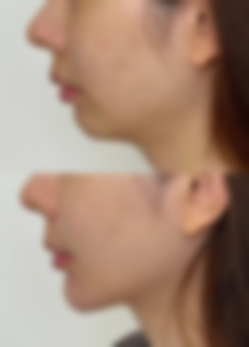 南通梵妮缇医疗美容诊所治疗反馈与口碑评价。