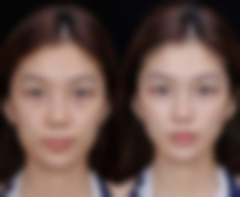 上饶德尔美客医疗美容门诊部擅长项目