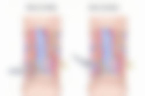 淄博丽滋汇整形医院治疗反馈与口碑评价。