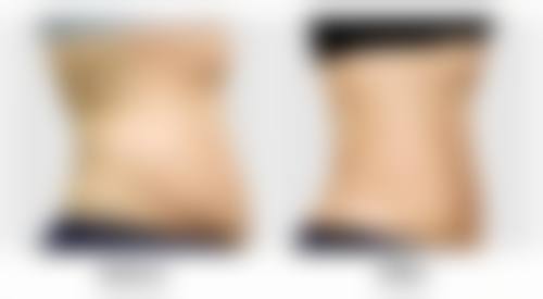 石家庄素美一禾医疗美容预约挂号方式。