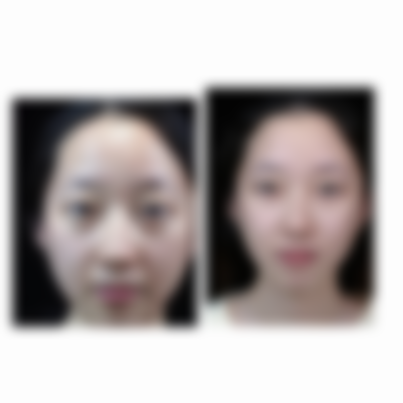 三门峡华美整形预约挂号