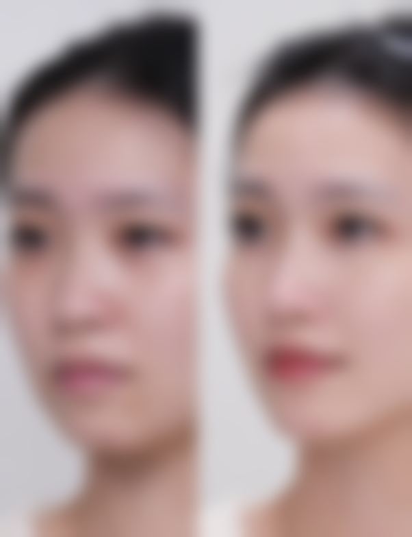 石家庄素美一禾医疗美容2026年价格收费表：