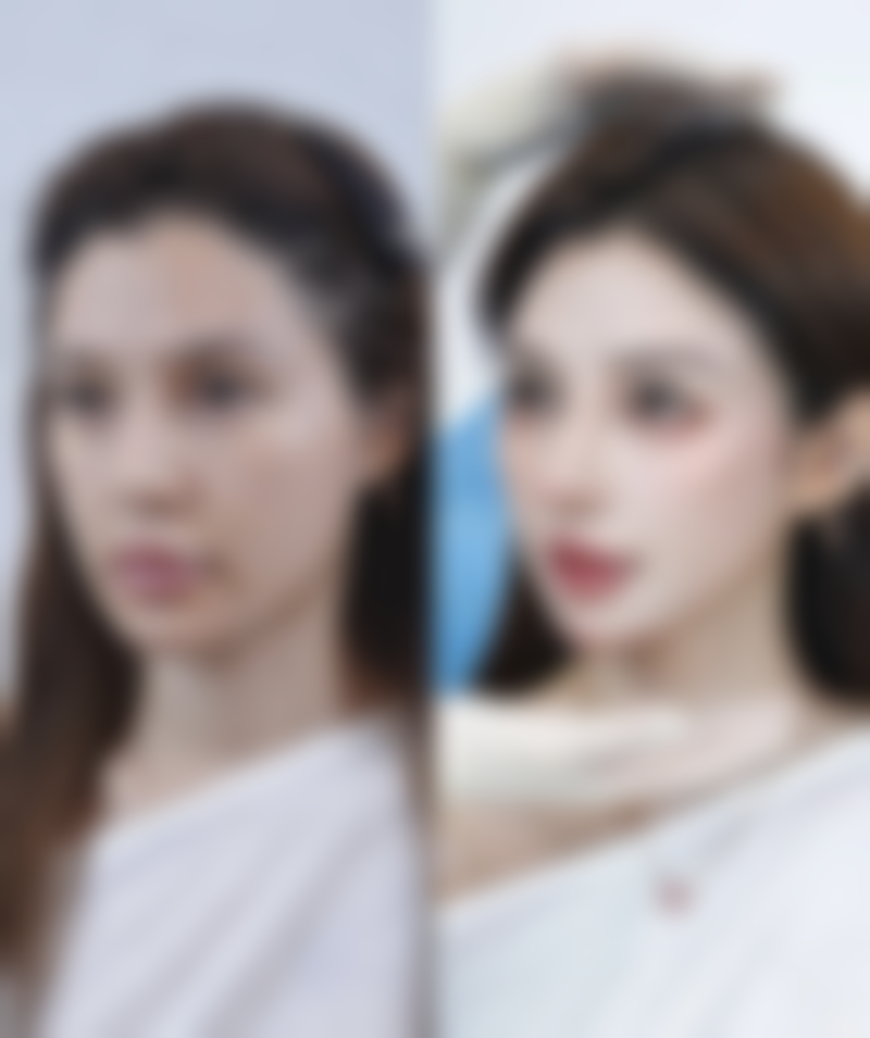 Herb整形外科任奎卓医生技术怎么样