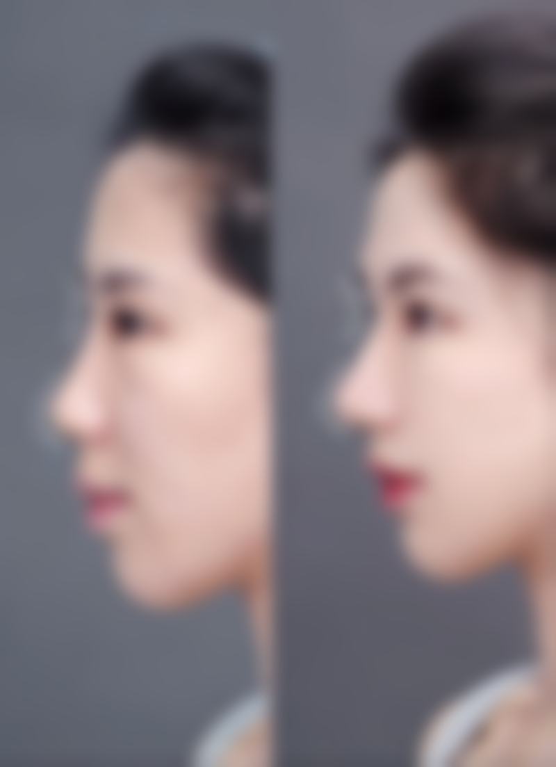 安晶玉医生技术怎么样