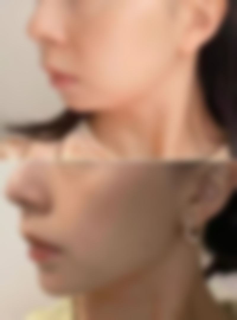 张家口华妍医疗美容诊所擅长项目。