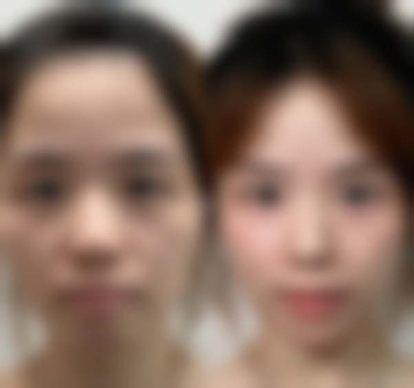 陕西韩媚整形医院口碑评价与项目分享：