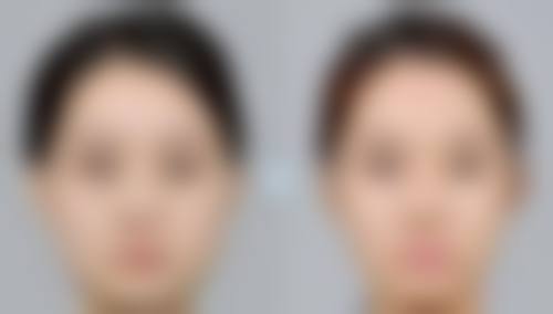 三明市第五医院美容整形科擅长项目