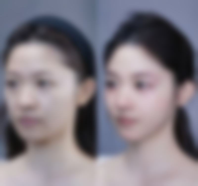 天津奥霏医疗美容诊所口碑评价与项目分享: