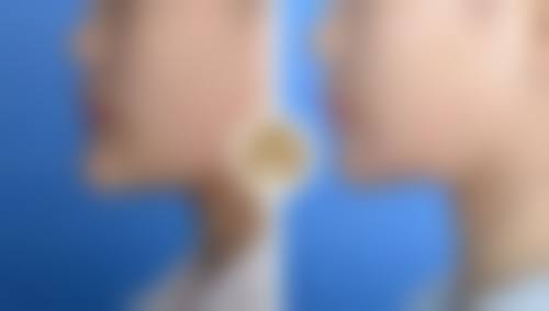 深圳微姿医疗美容整形医院收费价格表