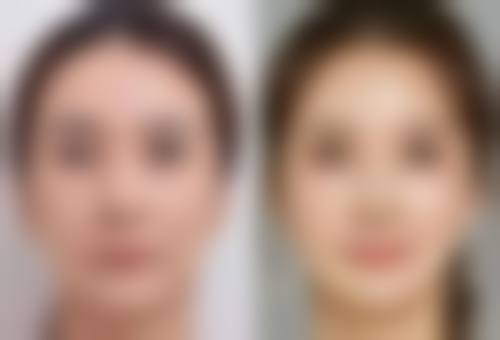 大庆市绣颜整形医疗美容门诊部收费价格表