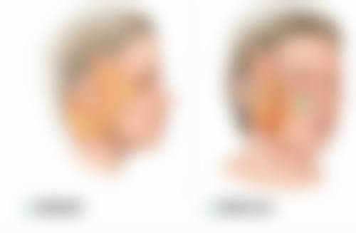 科凡美医疗管理有限公司易俗河医疗美容诊所口碑评价与项目分享：