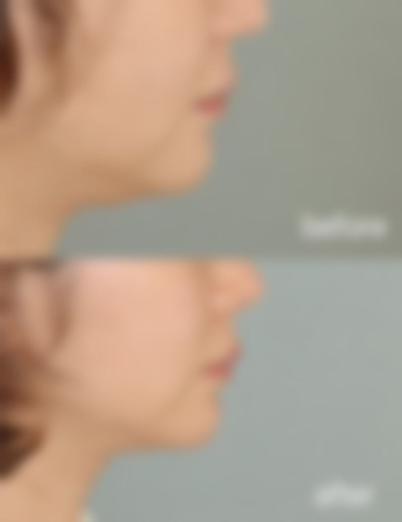 台州恩璨医疗美容门诊部乘车路线：