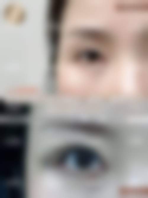 宋盈澄医生擅长项目