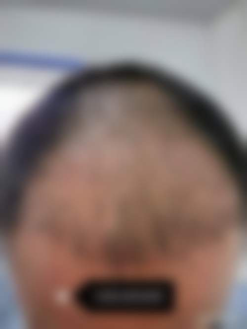 宋盈澄医生技术或实力