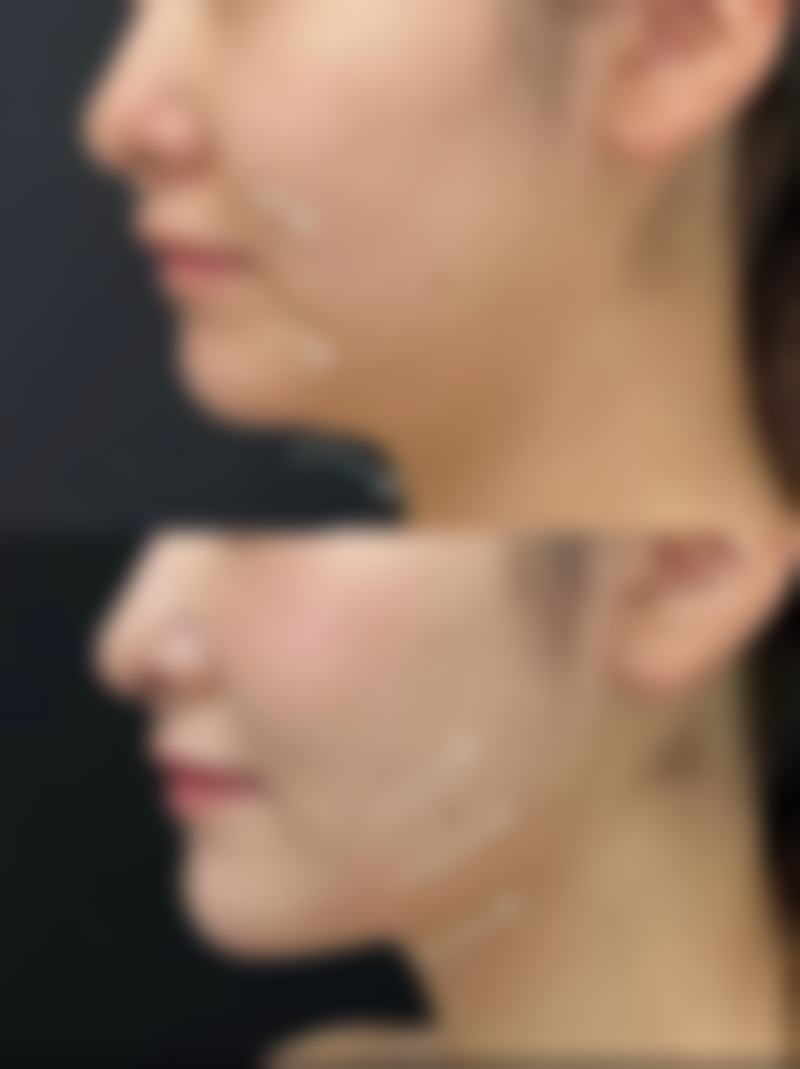 苏州美夏林医疗美容口碑评价与项目分享：