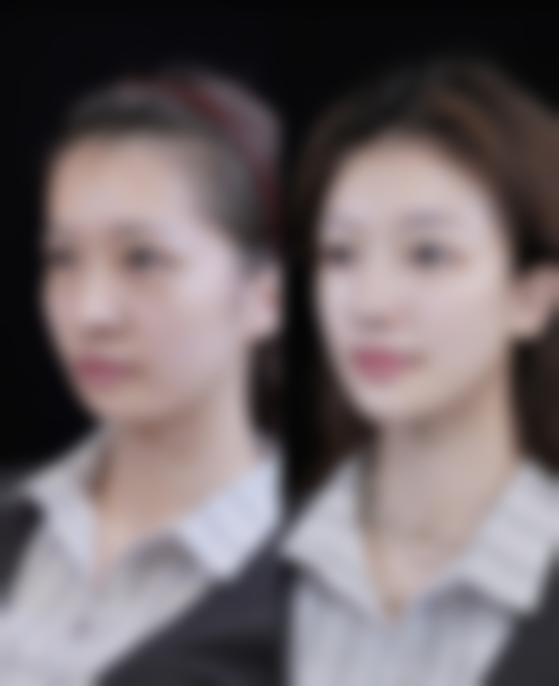 巴中系美医疗美容门诊部治疗反馈与口碑评价。