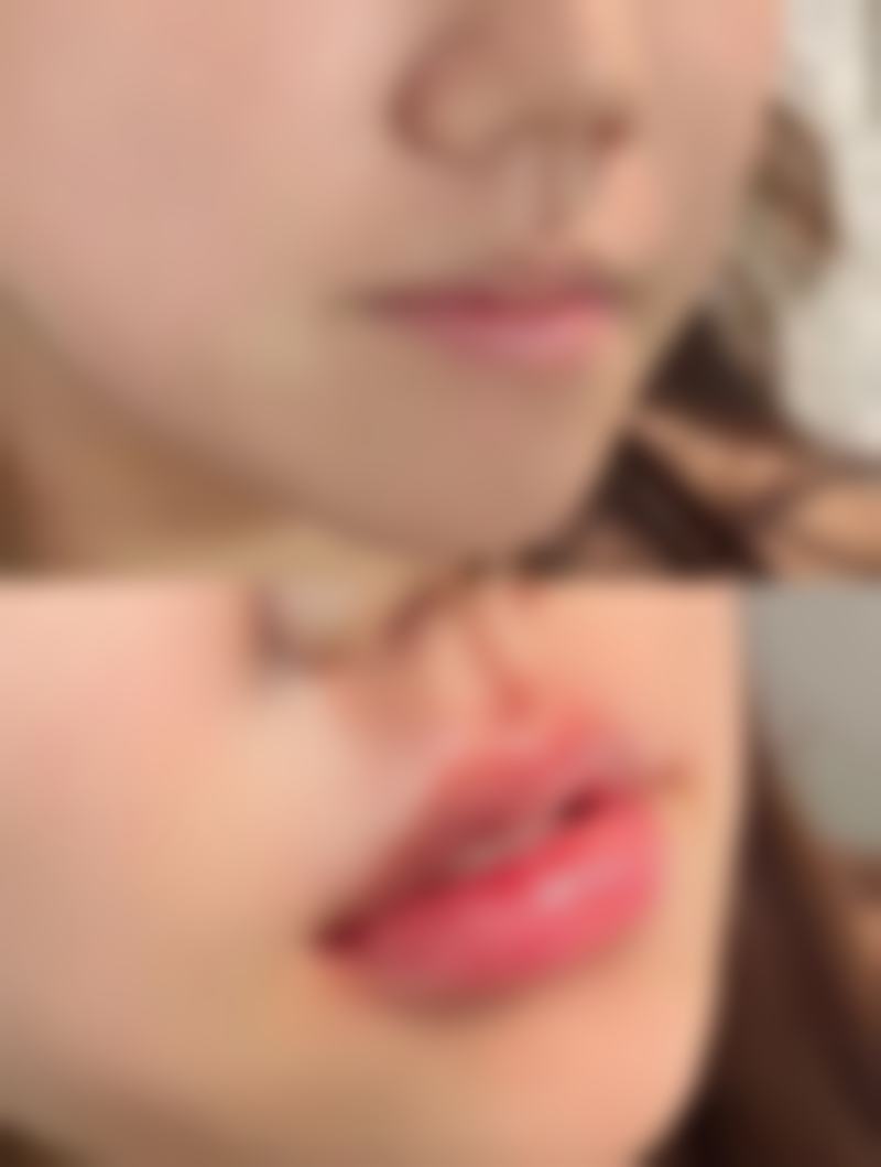 鞍山英威医疗美容门诊部擅长项目