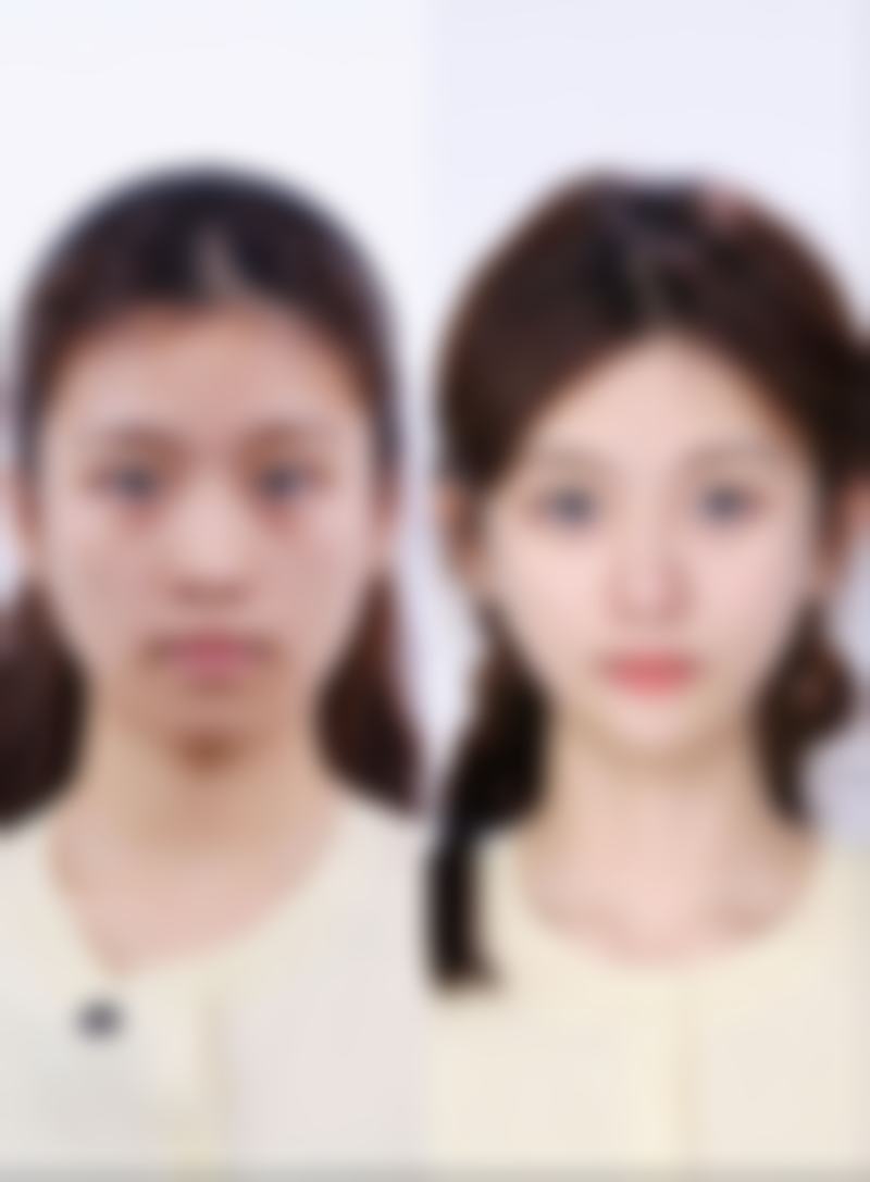 鞍山英威医疗美容门诊部口碑评价与项目分享: