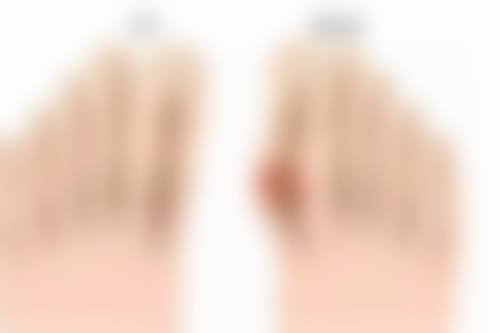 陈润医生技术实力亮点
