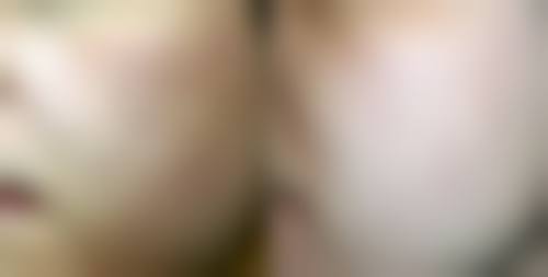 杭州倩兮医疗美容诊所治疗反馈与口碑评价。