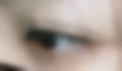 泗阳惠熙整形医院预约挂号