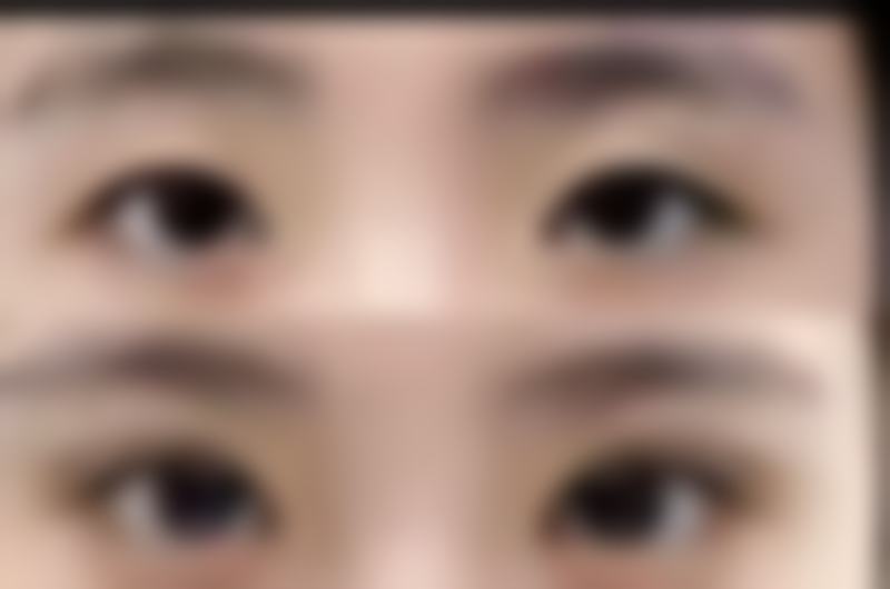 襄阳倍加美整形医院预约挂号方式