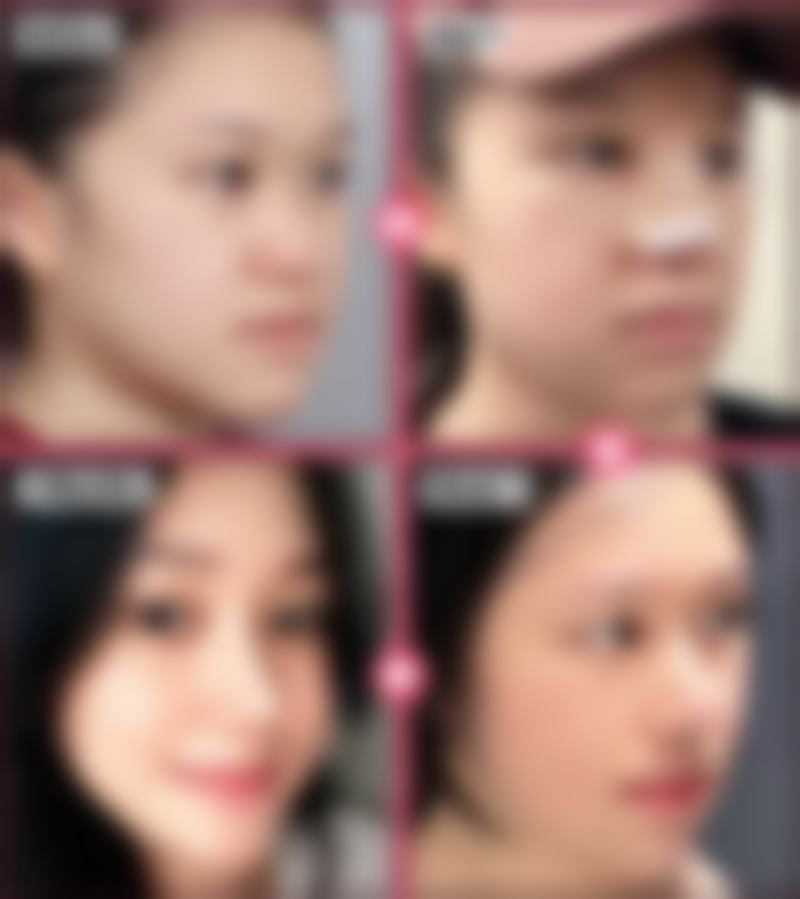 贵阳卿阳壹美整形医生团队经验稳定。